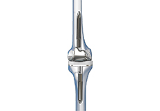 Correction of a Failed Knee Replacement