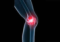 Knee Pain